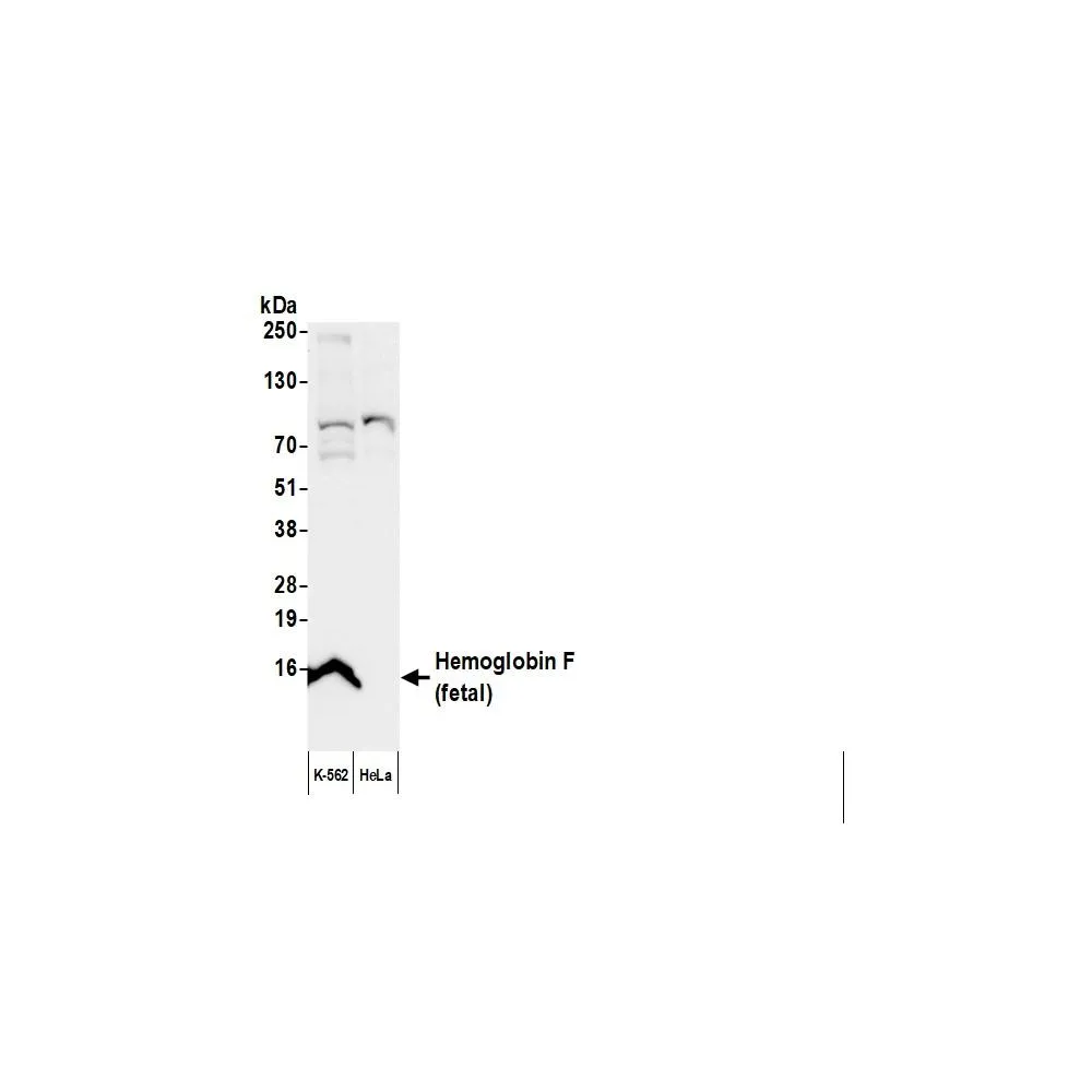 Sheep anti-Human Hemoglobin F Antibody Affinity Purified