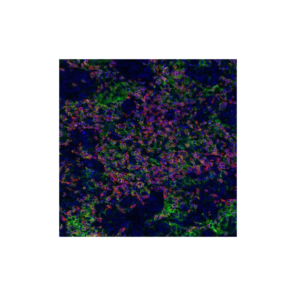 Immune Checkpoint PathPlex® Panel (CD3E, CD8 alpha, PD-L1)