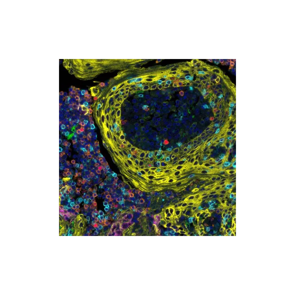 Immunosuppression PathPlex® Panel (CD3E, Cytokeratin, CD8 alpha, CD68, PD-L1, FOXP3)