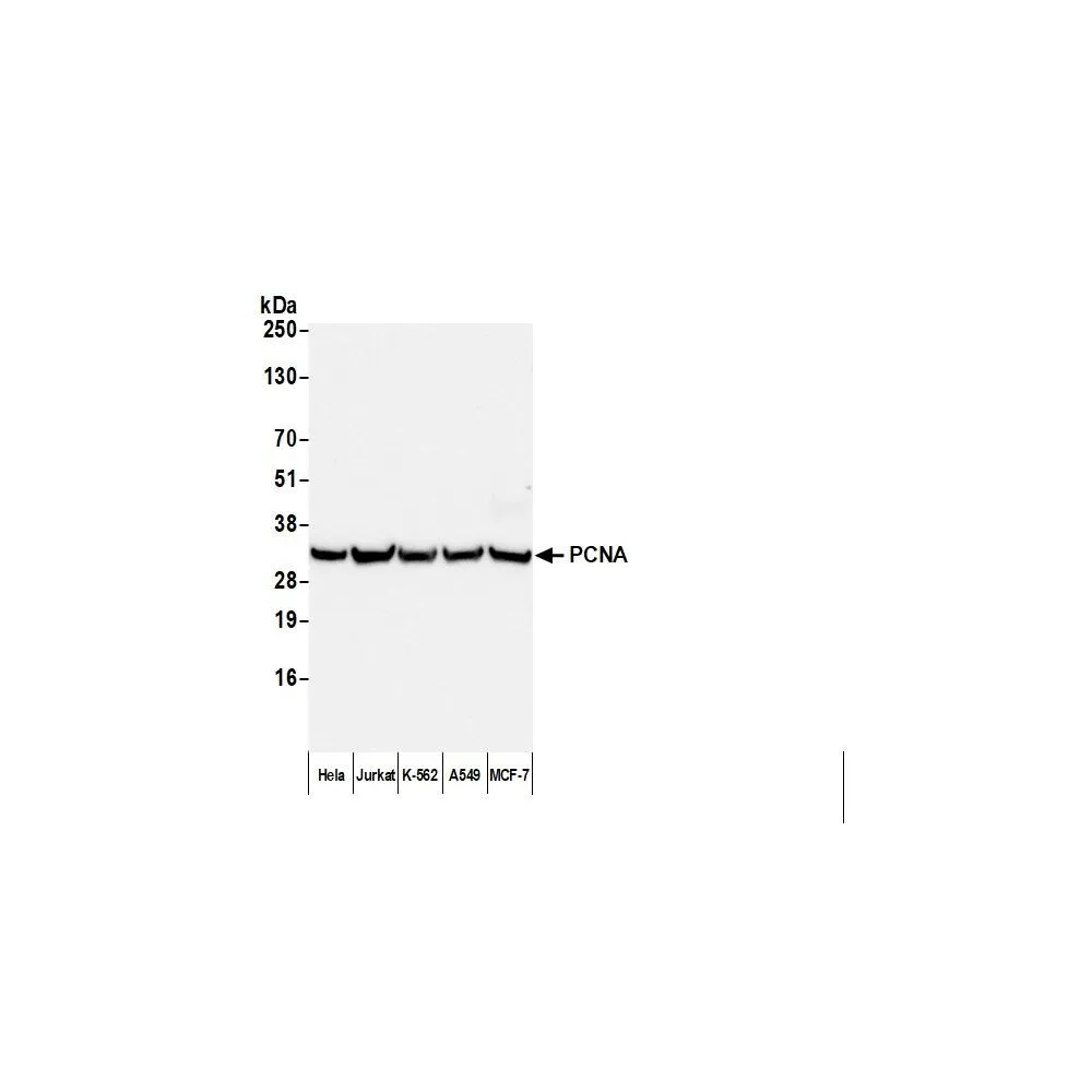 F(ab')2 Donkey anti-Mouse IgG Heavy and Light Chain Antibody Affinity Purified