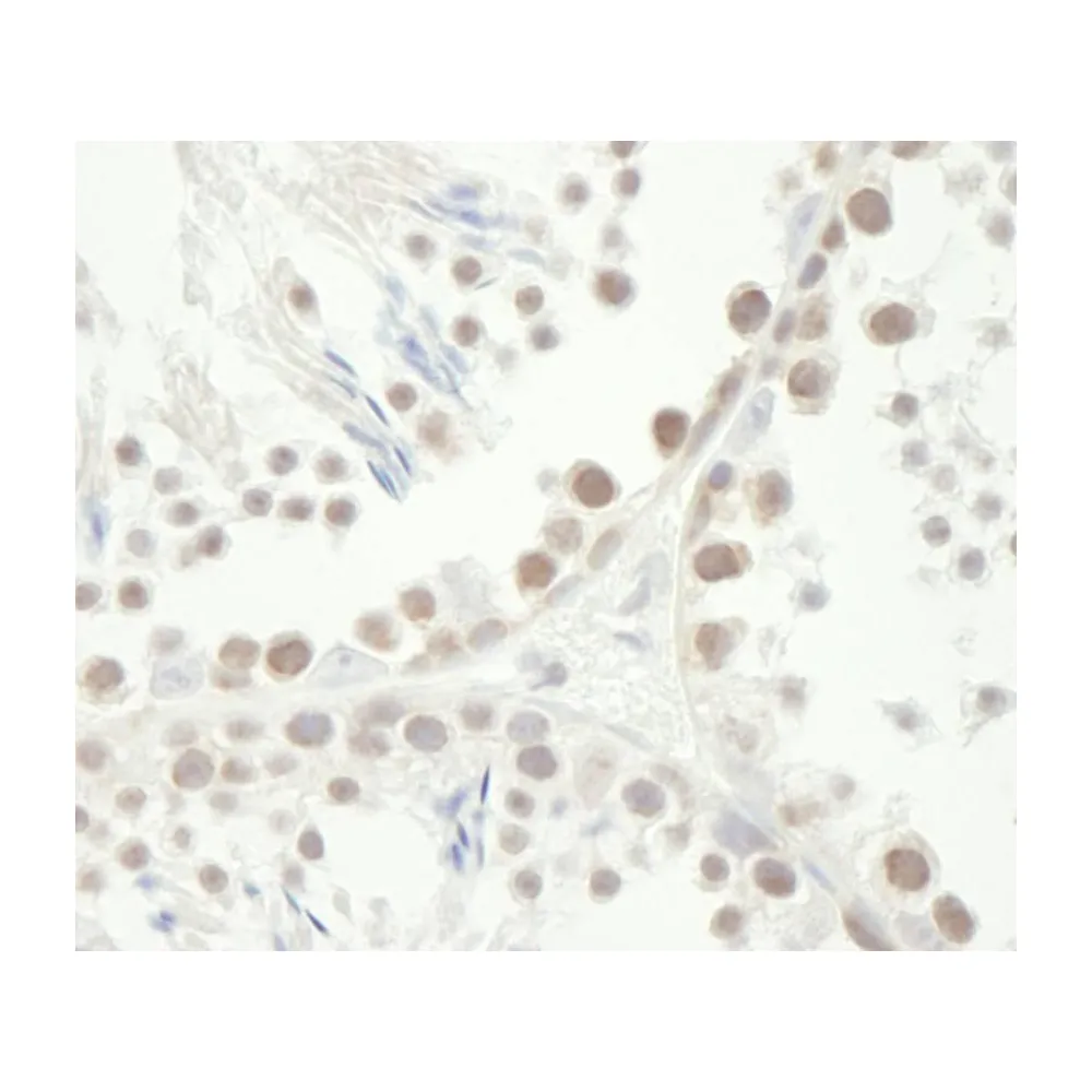 Rabbit anti-Chk1 IHC Antibody, Affinity Purified
