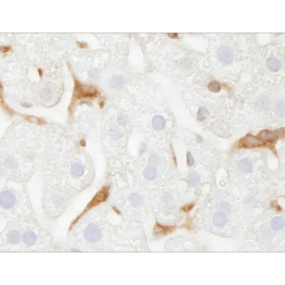 Rabbit anti-G6PD IHC Antibody, Affinity Purified