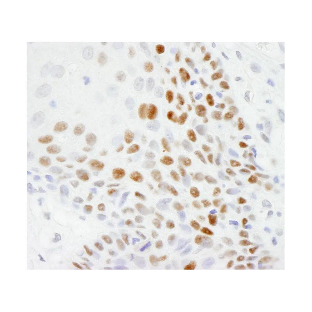 Rabbit anti-p53 IHC Antibody, Affinity Purified