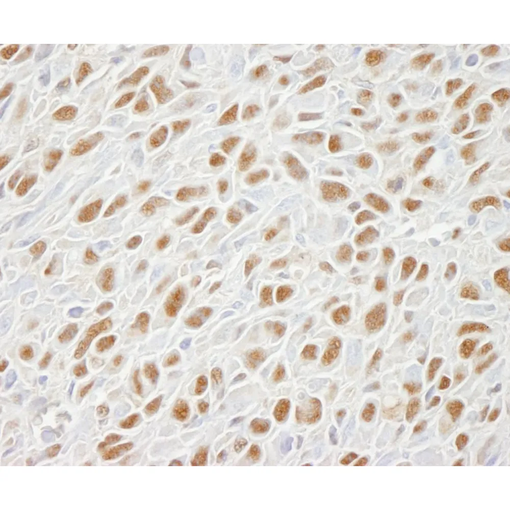 Rabbit anti-SMC1 IHC Antibody, Affinity Purified
