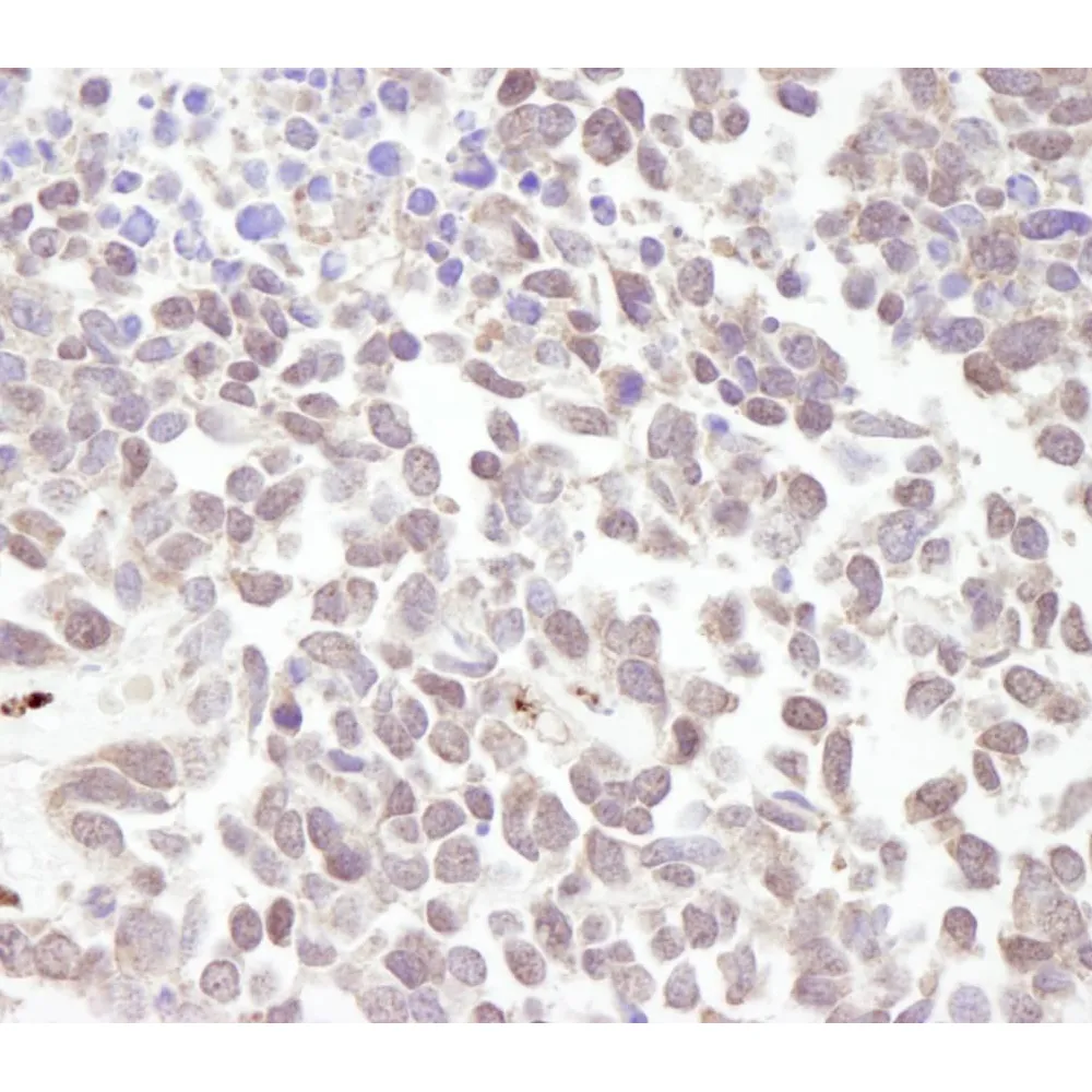 Rabbit anti-MTA1 IHC Antibody, Affinity Purified