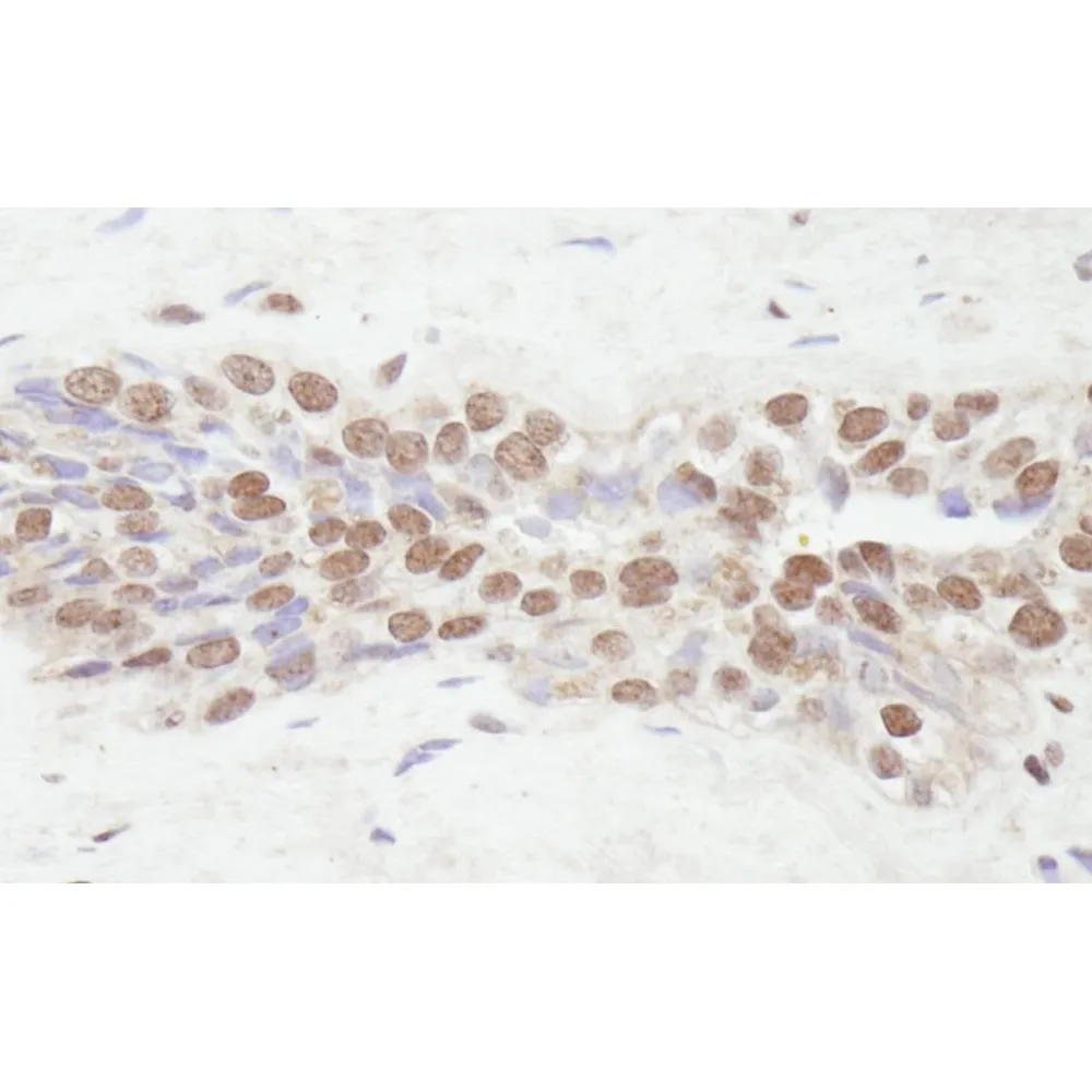 Rabbit anti-NCOA2/SRC2 IHC Antibody, Affinity Purified