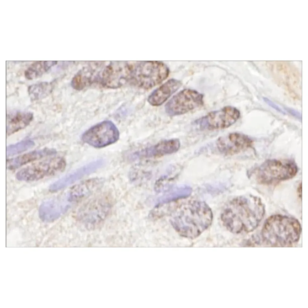 Rabbit anti-ATM IHC Antibody, Affinity Purified