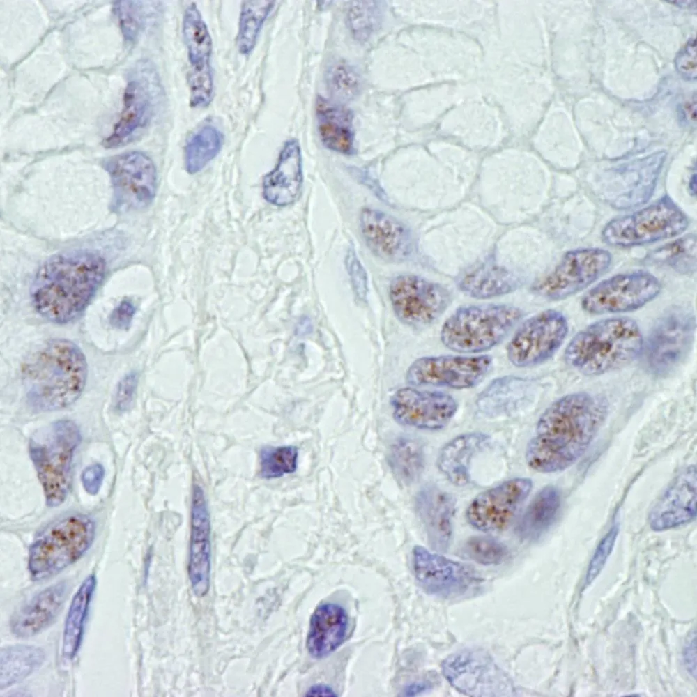 Rabbit anti-CDK11 IHC Antibody, Affinity Purified