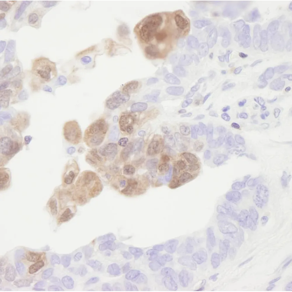 Rabbit anti-CamK4 IHC Antibody, Affinity Purified