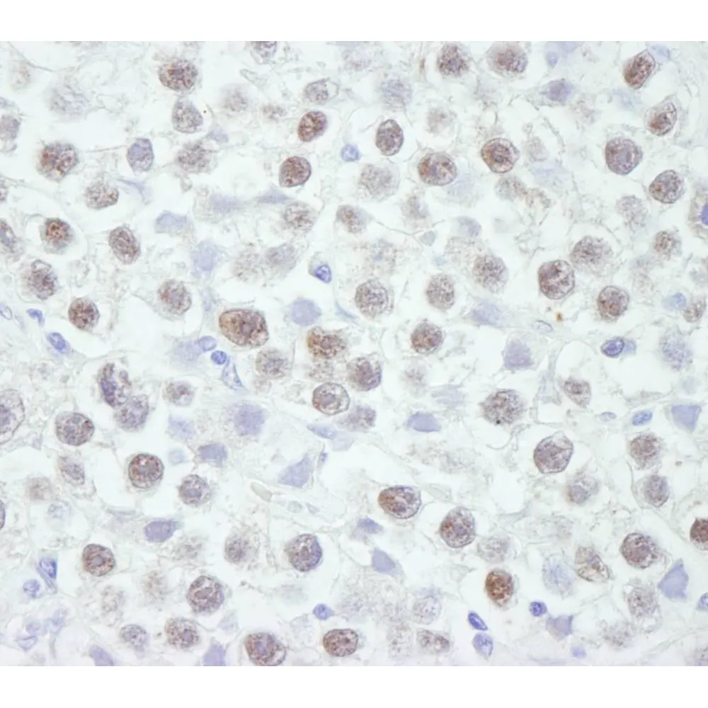 Rabbit anti-Chk2 IHC Antibody, Affinity Purified