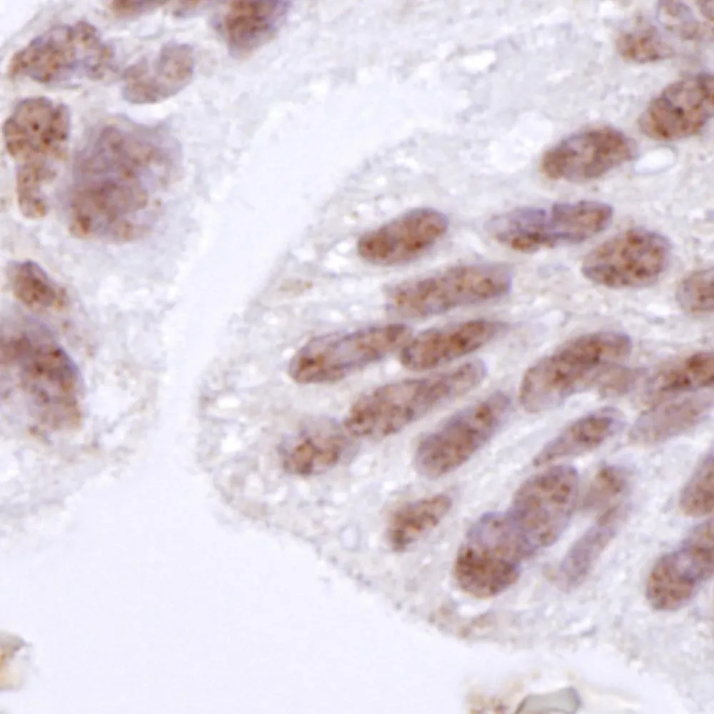 Rabbit anti-CTCF IHC Antibody, Affinity Purified