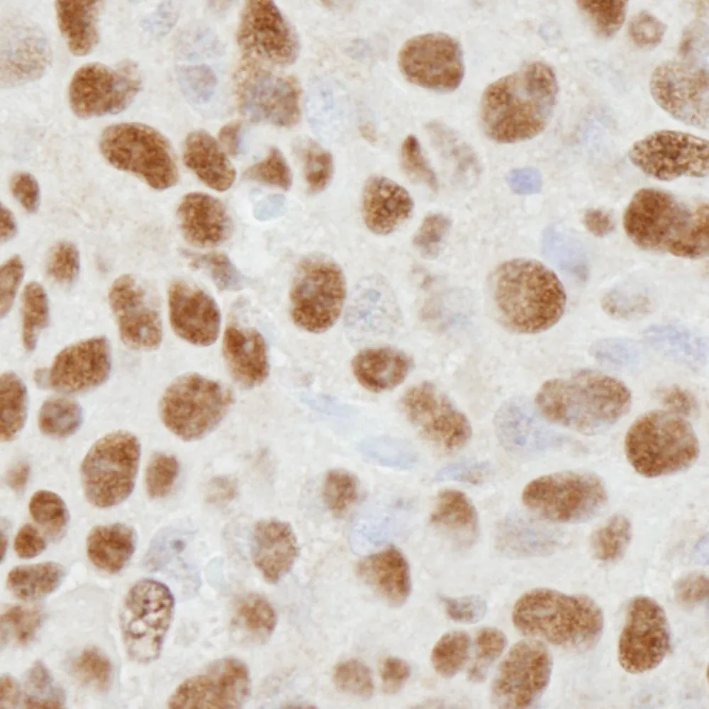 Rabbit anti-HDAC1 IHC Antibody, Affinity Purified