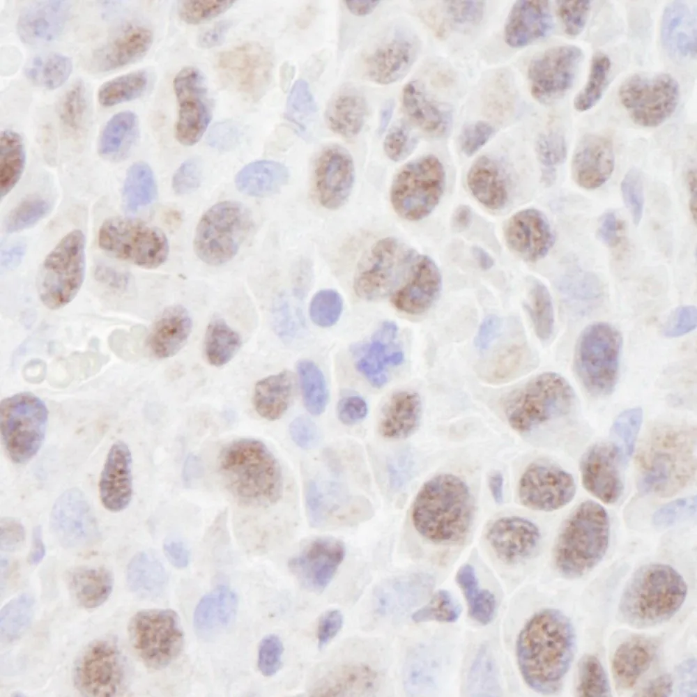 Rabbit anti-HDAC2 IHC Antibody, Affinity Purified