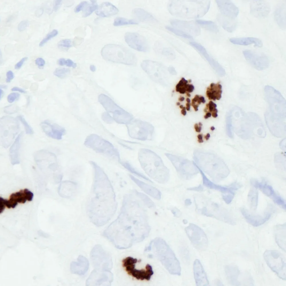 Rabbit anti-Phospho Histone H3 (S10) IHC Antibody, Affinity Purified