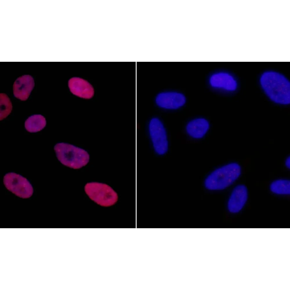 Rabbit anti-Phospho KAP-1 (S824) IHC Antibody, Affinity Purified