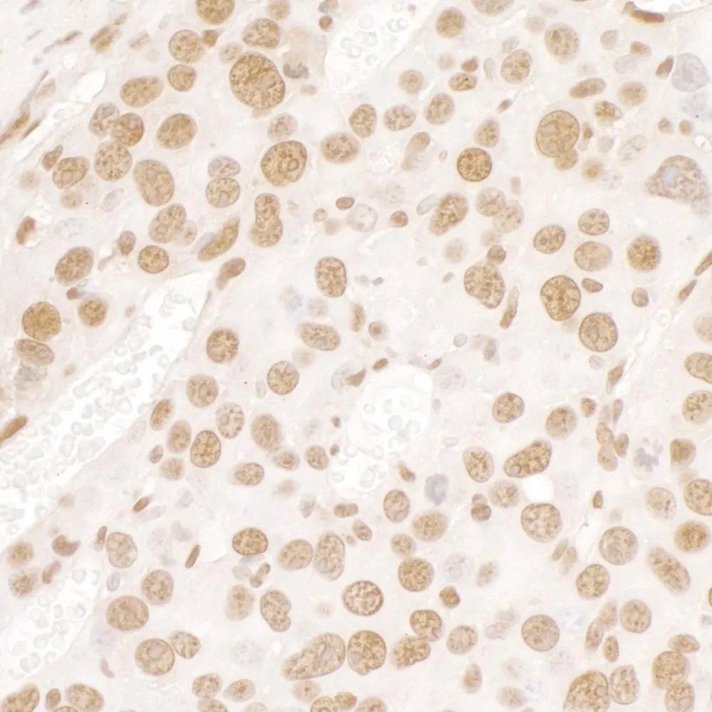 Rabbit anti-FUS IHC Antibody, Affinity Purified