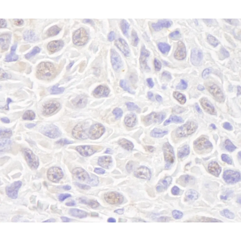 Rabbit anti-Rad50 IHC Antibody, Affinity Purified