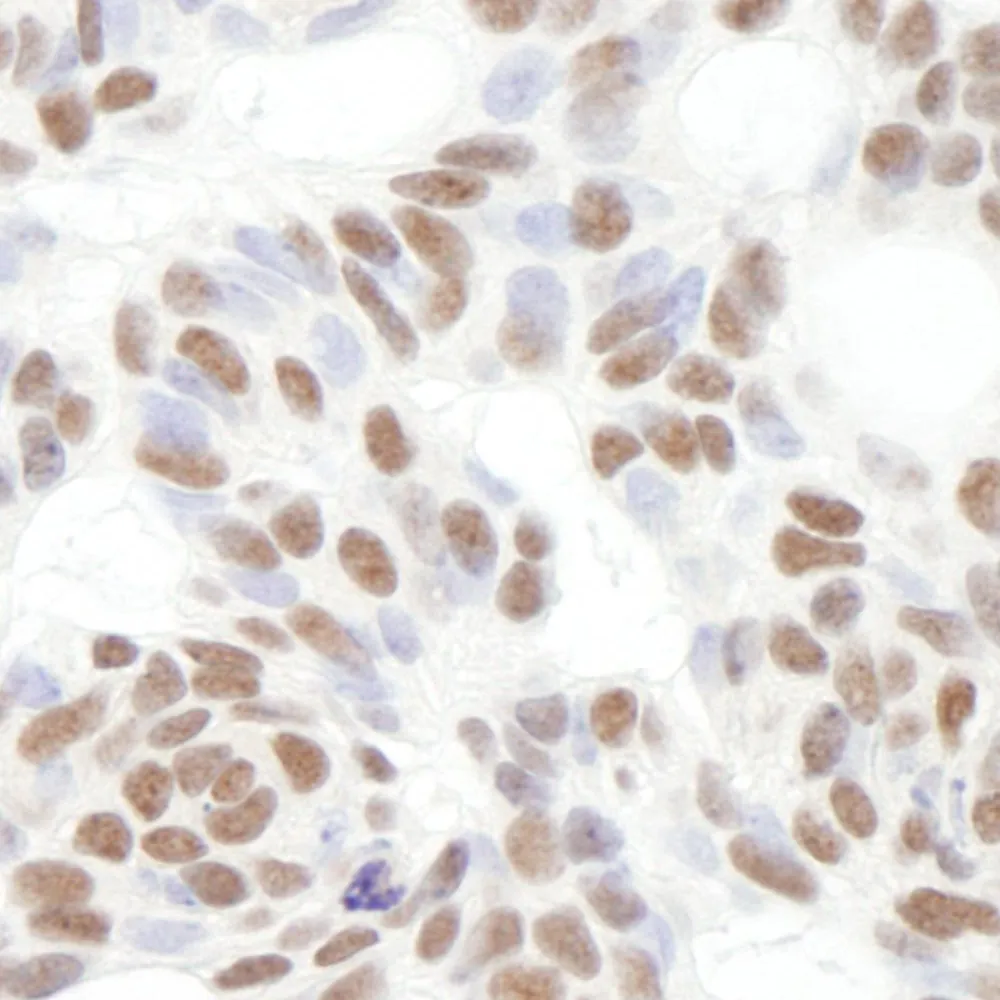 Rabbit anti-Bcl11b IHC Antibody, Affinity Purified