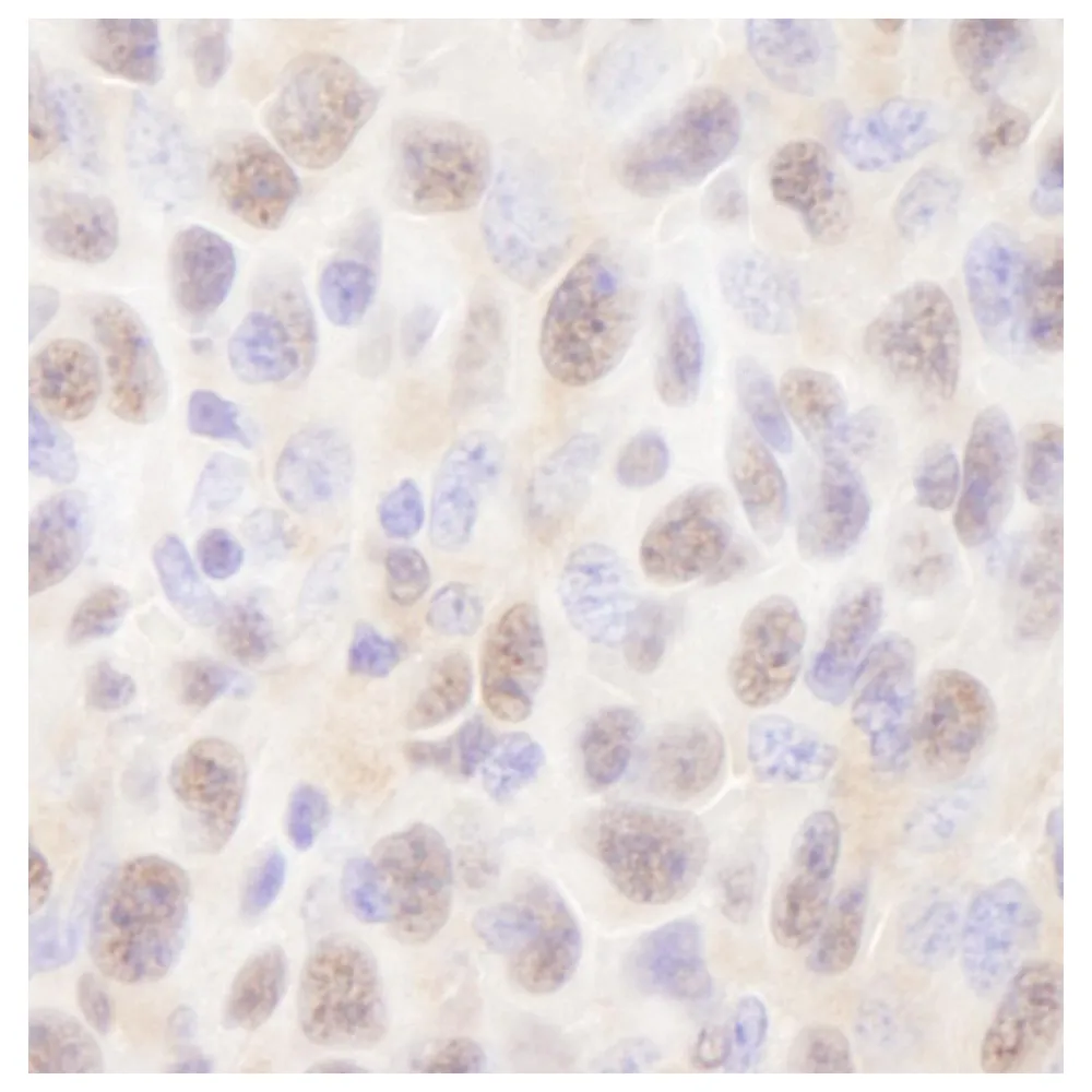 Rabbit anti-Rad6 IHC Antibody, Affinity Purified