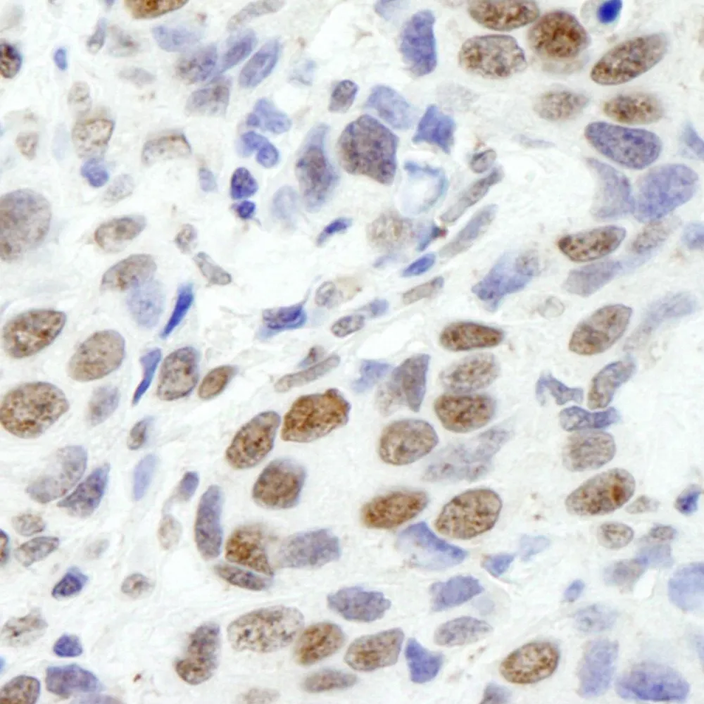 Rabbit anti-EWS IHC Antibody, Affinity Purified