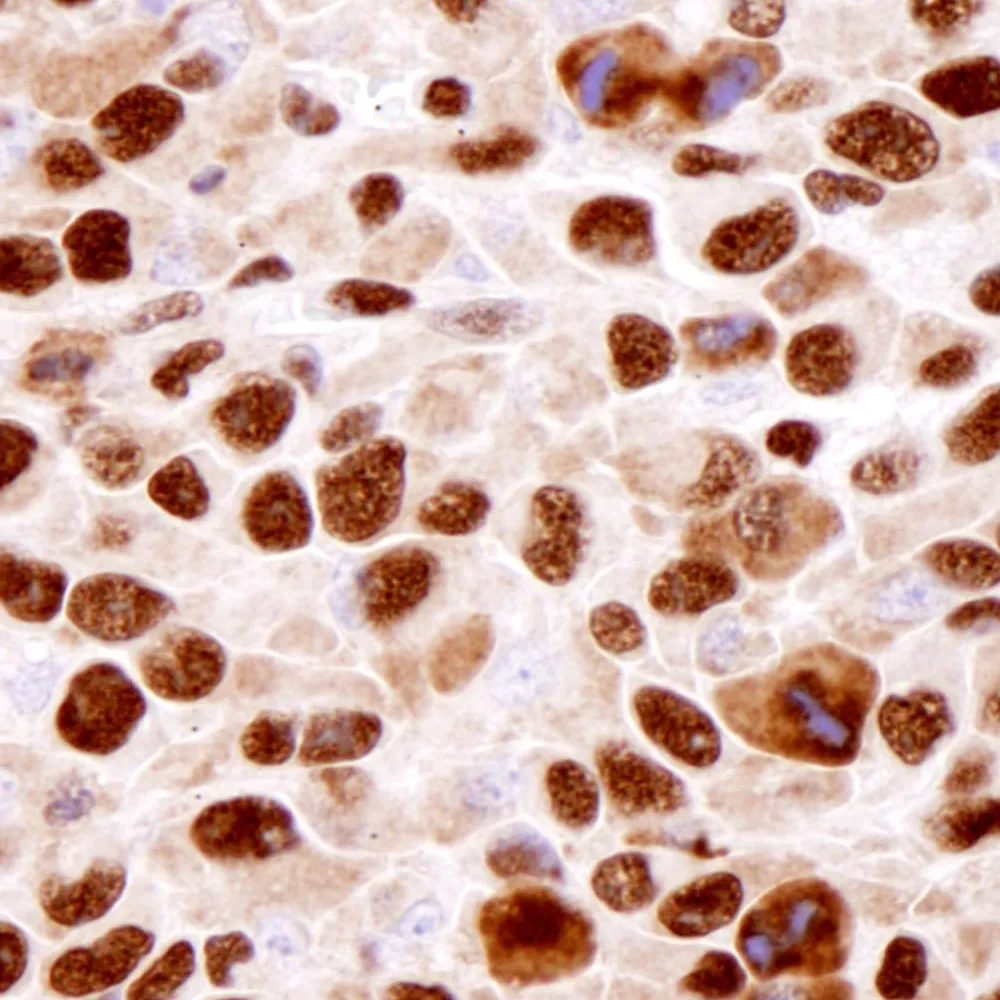 Rabbit anti-hnRNP-K IHC Antibody, Affinity Purified