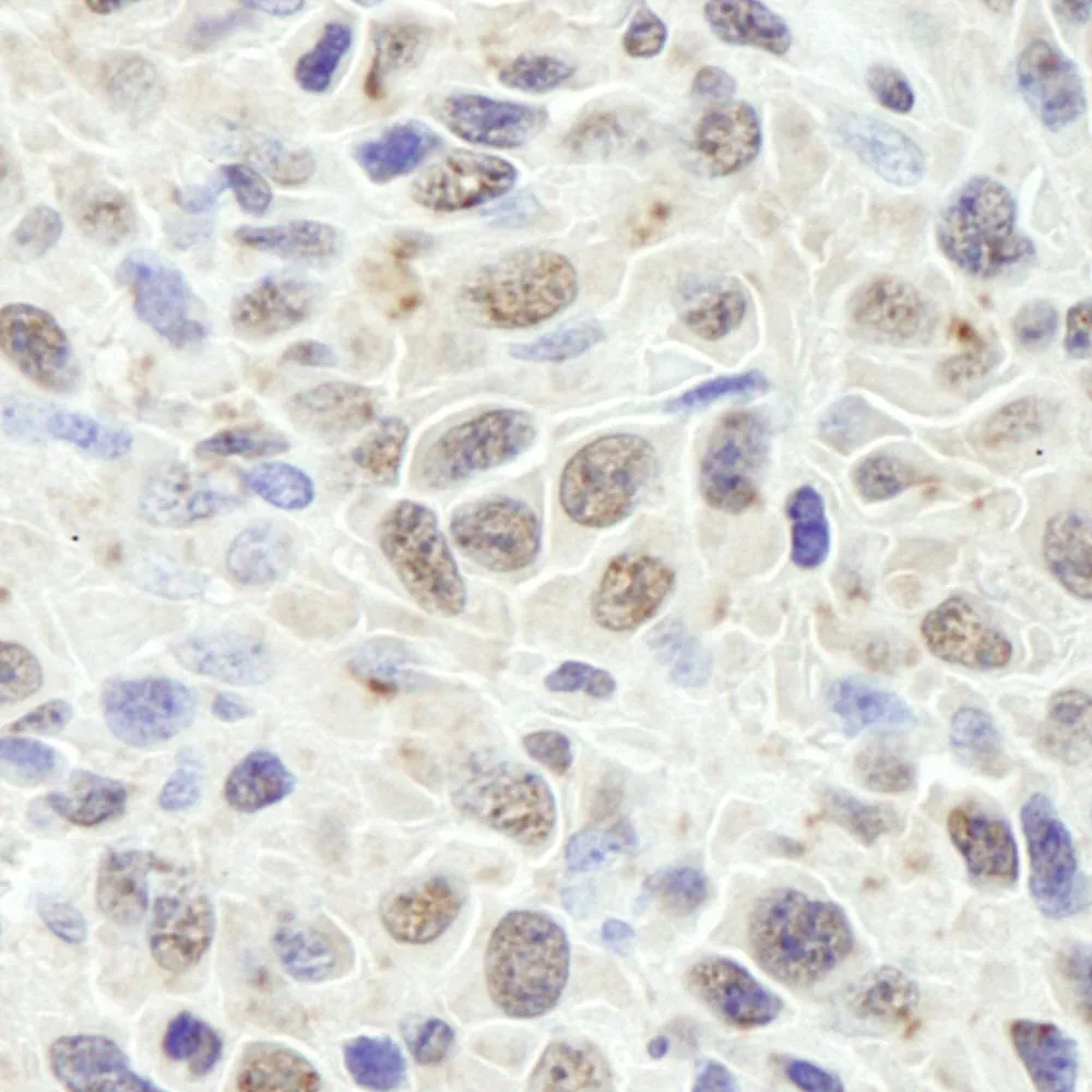 Rabbit anti-CCAR1 IHC Antibody, Affinity Purified