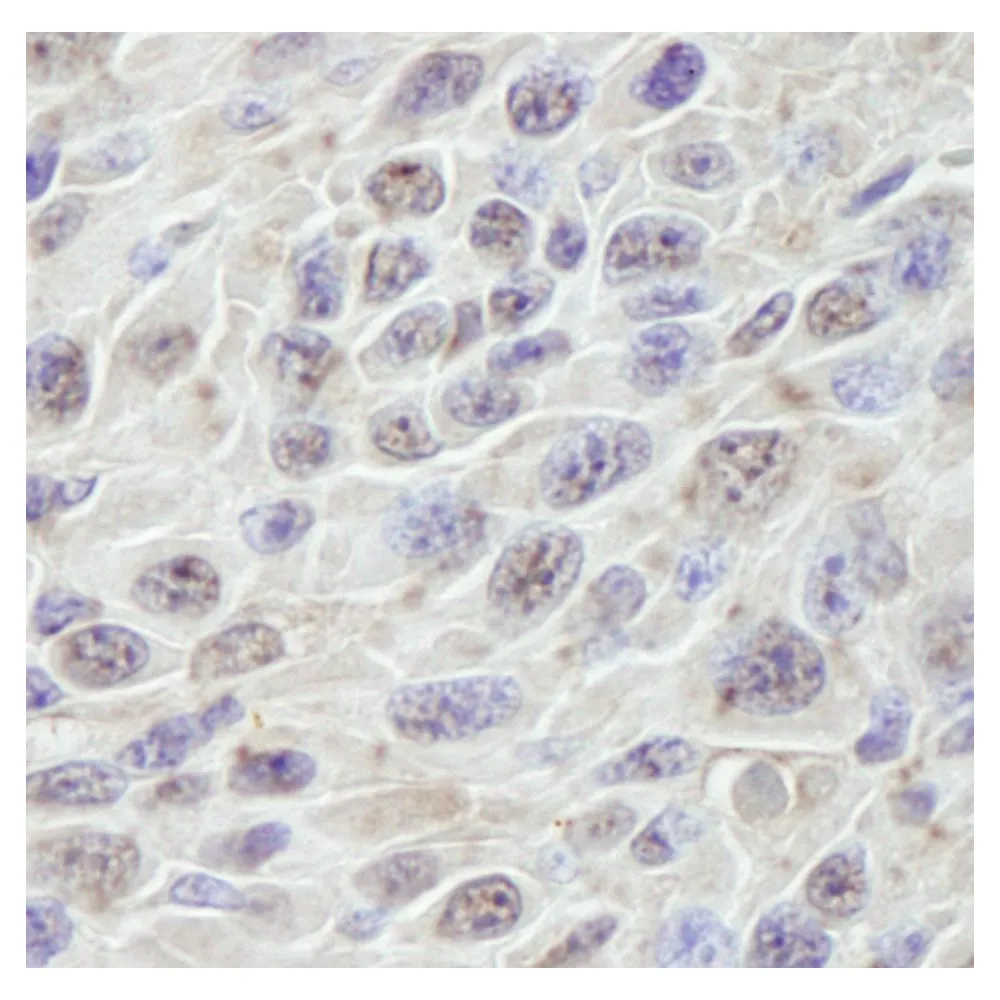 Rabbit anti-PRKRIR IHC Antibody, Affinity Purified