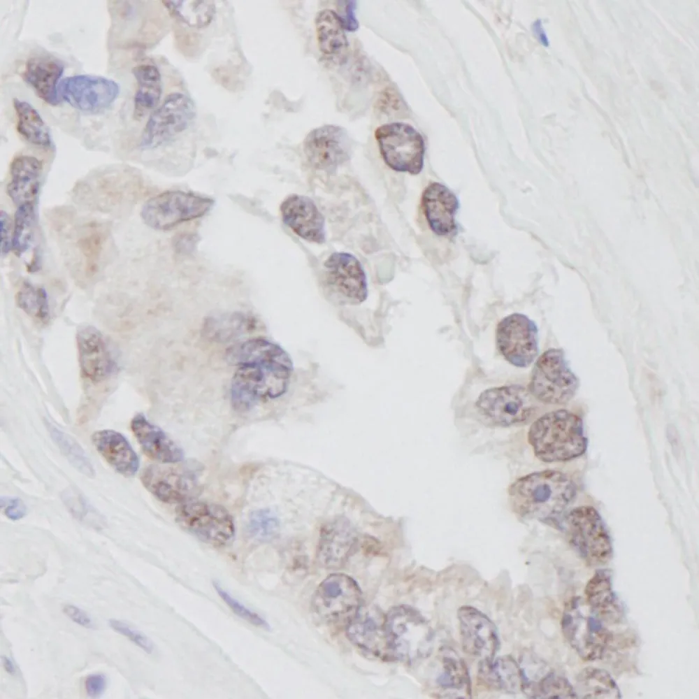Rabbit anti-RNF40 IHC Antibody, Affinity Purified