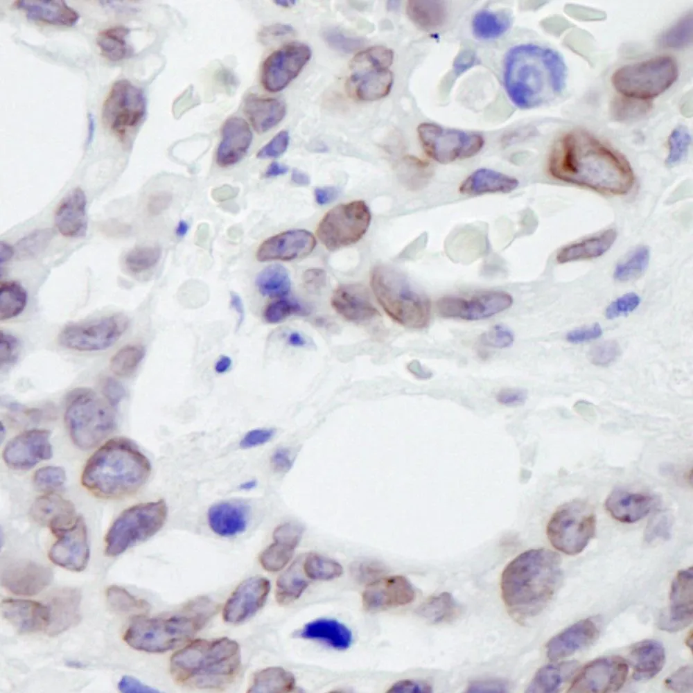 Rabbit anti-NUP214 IHC Antibody, Affinity Purified