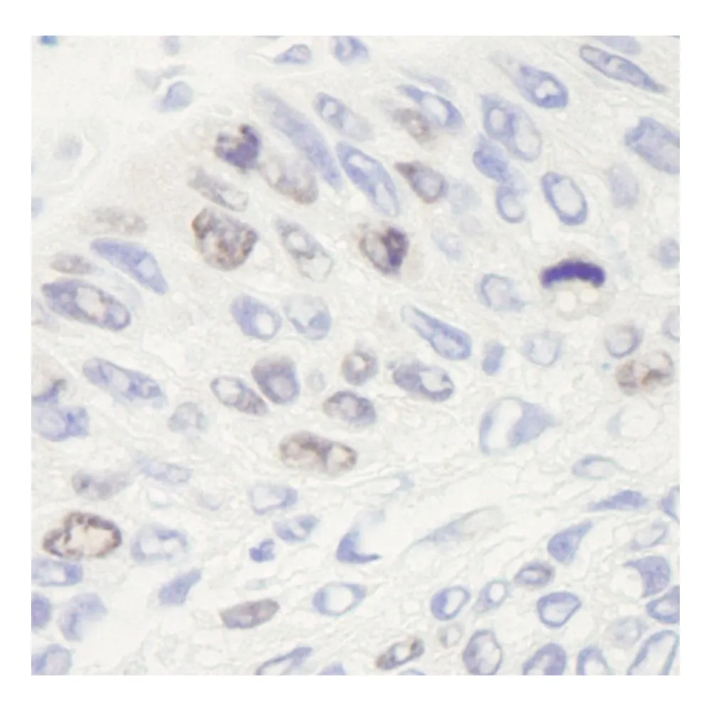 Rabbit anti-Topo II Alpha IHC Antibody, Affinity Purified