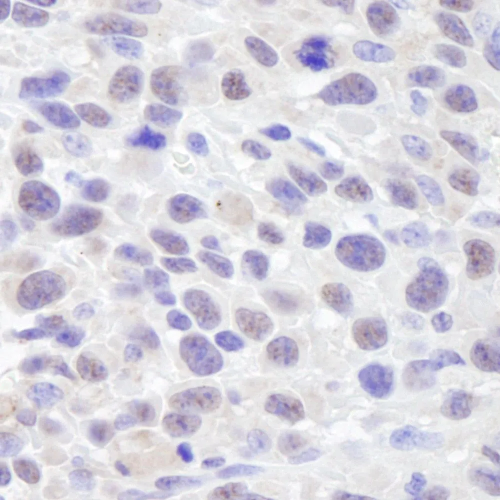 Rabbit anti-ASH2 IHC Antibody, Affinity Purified