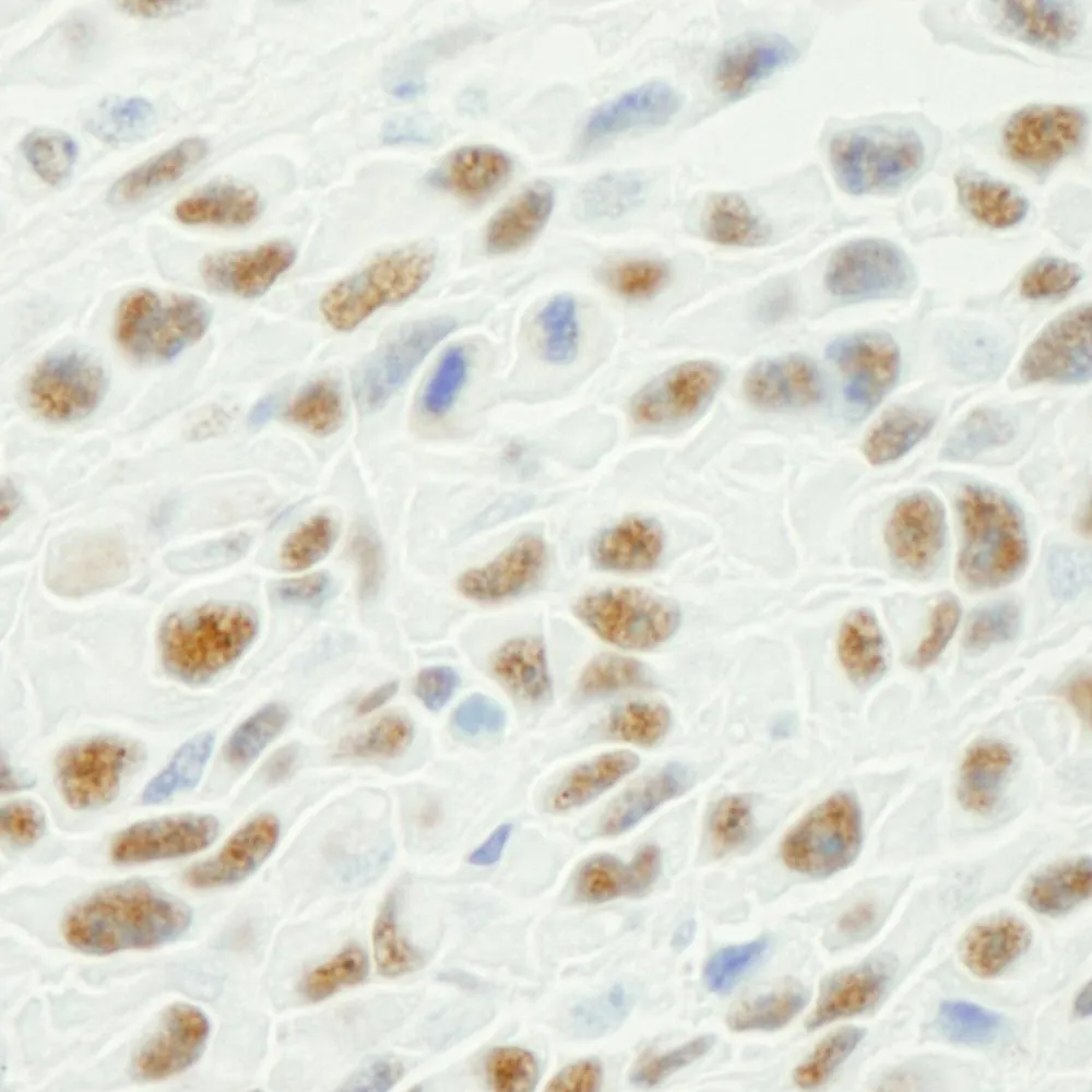 Rabbit anti-Phospho XRCC1 (S461) IHC Antibody, Affinity Purified
