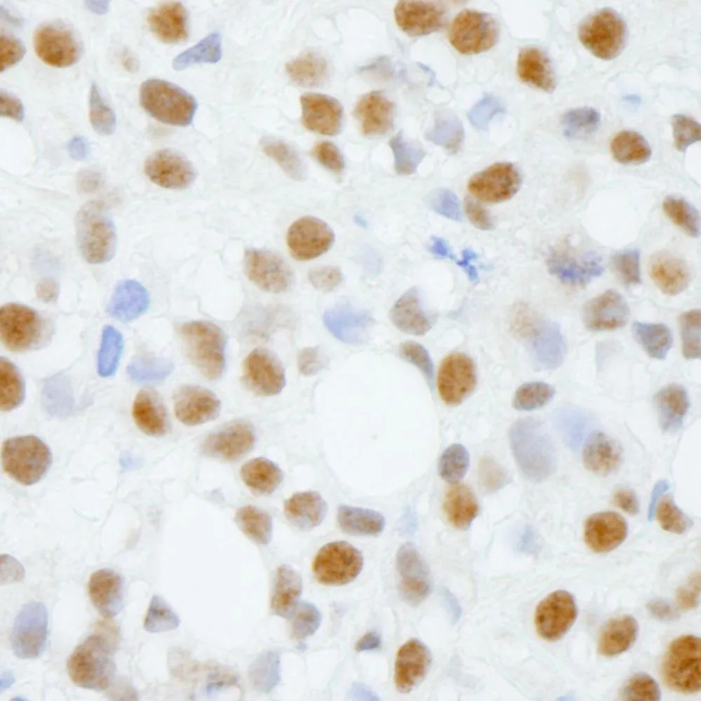 Rabbit anti-ADNP IHC Antibody, Affinity Purified