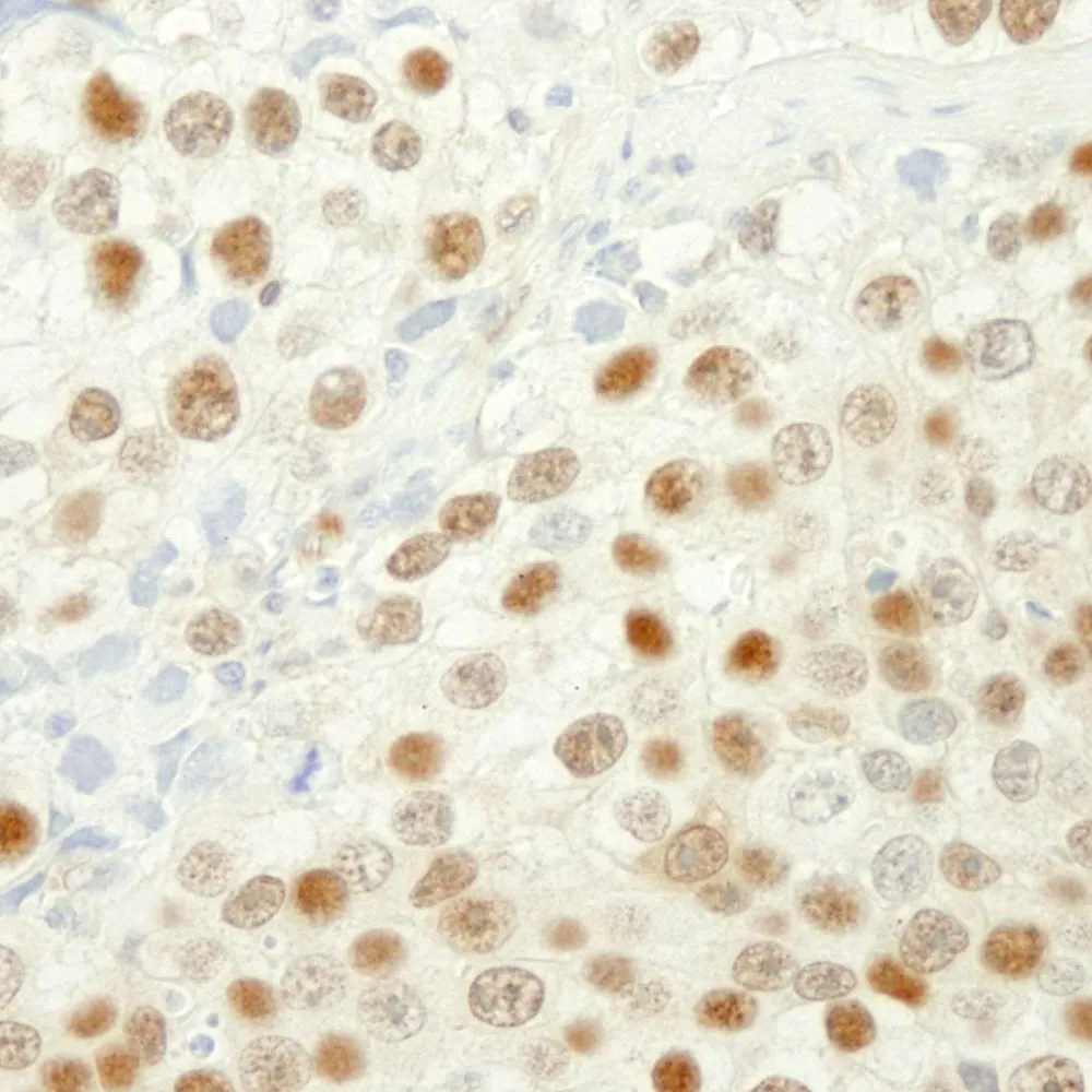 Goat anti-MSH6 IHC Antibody, Affinity Purified