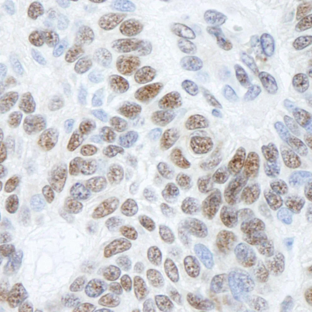 Rabbit anti-BHC110/LSD1 IHC Antibody, Affinity Purified