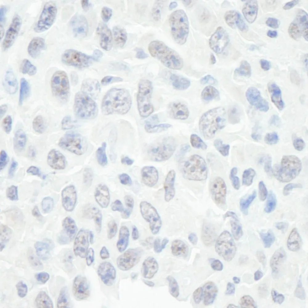 Rabbit anti-BAF57/SMARCE1 IHC Antibody, Affinity Purified
