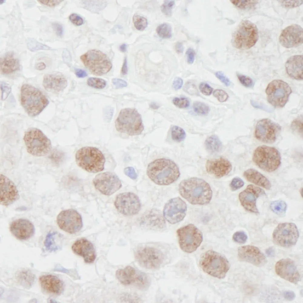 Rabbit anti-DDX1 IHC Antibody, Affinity Purified