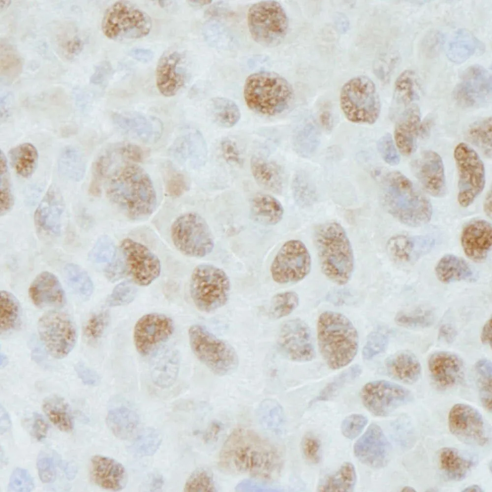 Rabbit anti-DDB1 IHC Antibody, Affinity Purified