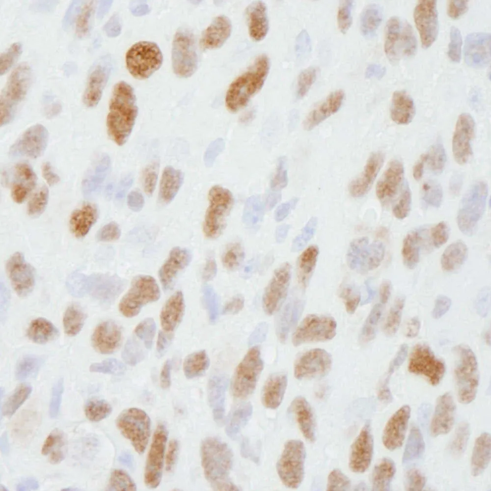 Rabbit anti-DBC1/p30 DBC IHC Antibody, Affinity Purified