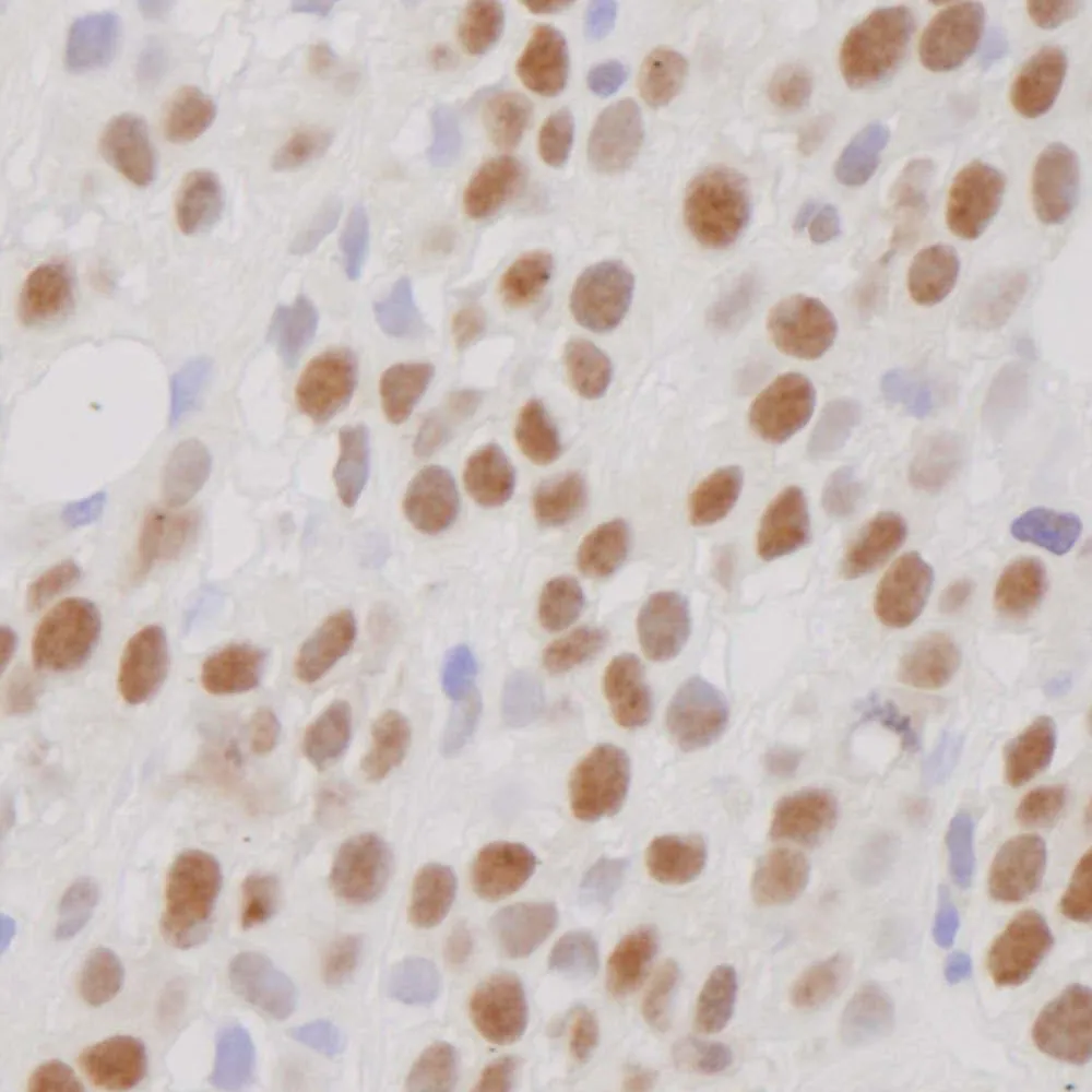 Rabbit anti-CoREST IHC Antibody, Affinity Purified