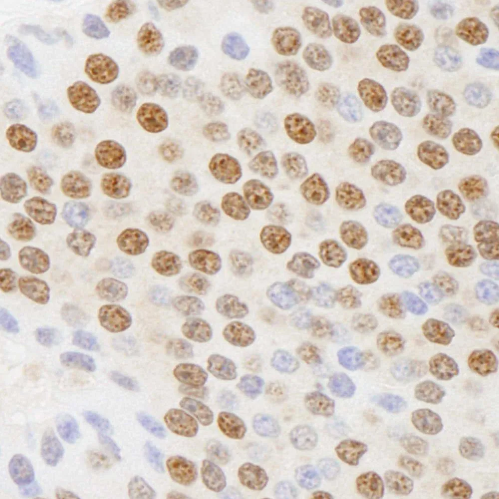 Rabbit anti-CTBP1 IHC Antibody, Affinity Purified