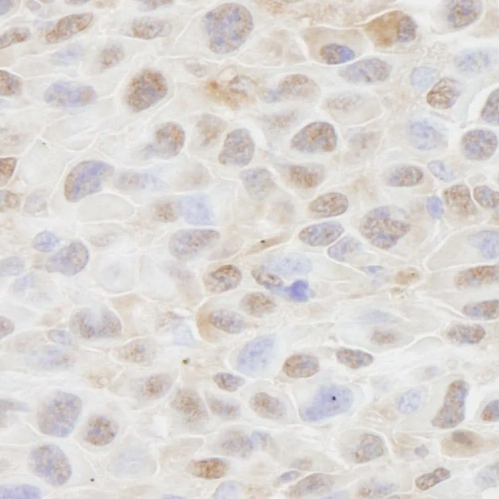 Rabbit anti-CSE1 IHC Antibody, Affinity Purified
