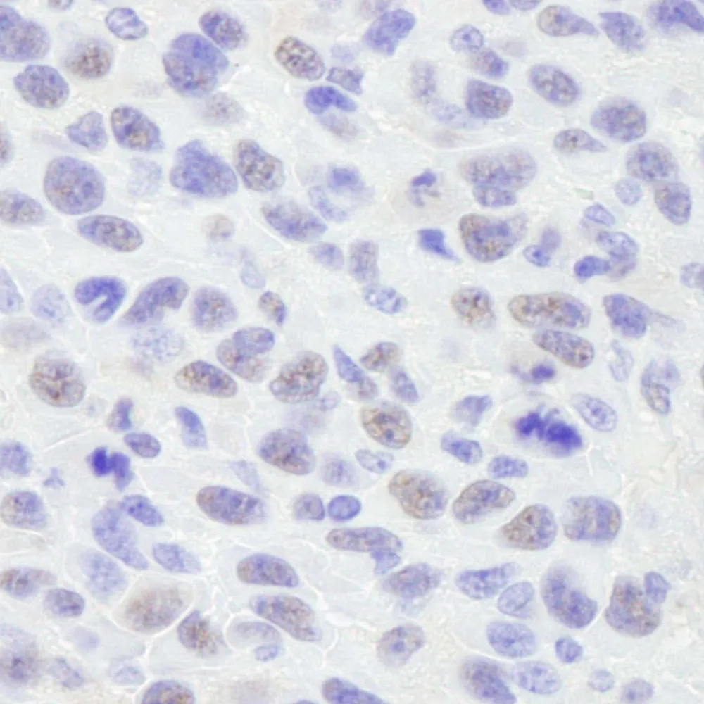 Rabbit anti-SMAR1/BANP IHC Antibody, Affinity Purified