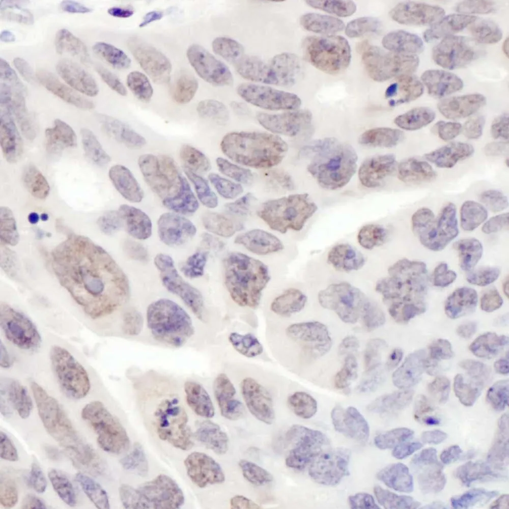 Rabbit anti-REST IHC Antibody, Affinity Purified