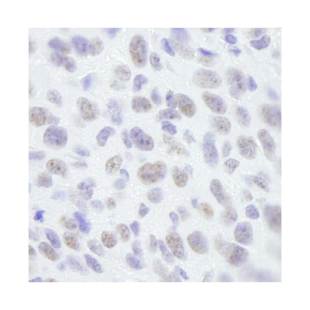 Rabbit anti-SAFB1 IHC Antibody, Affinity Purified