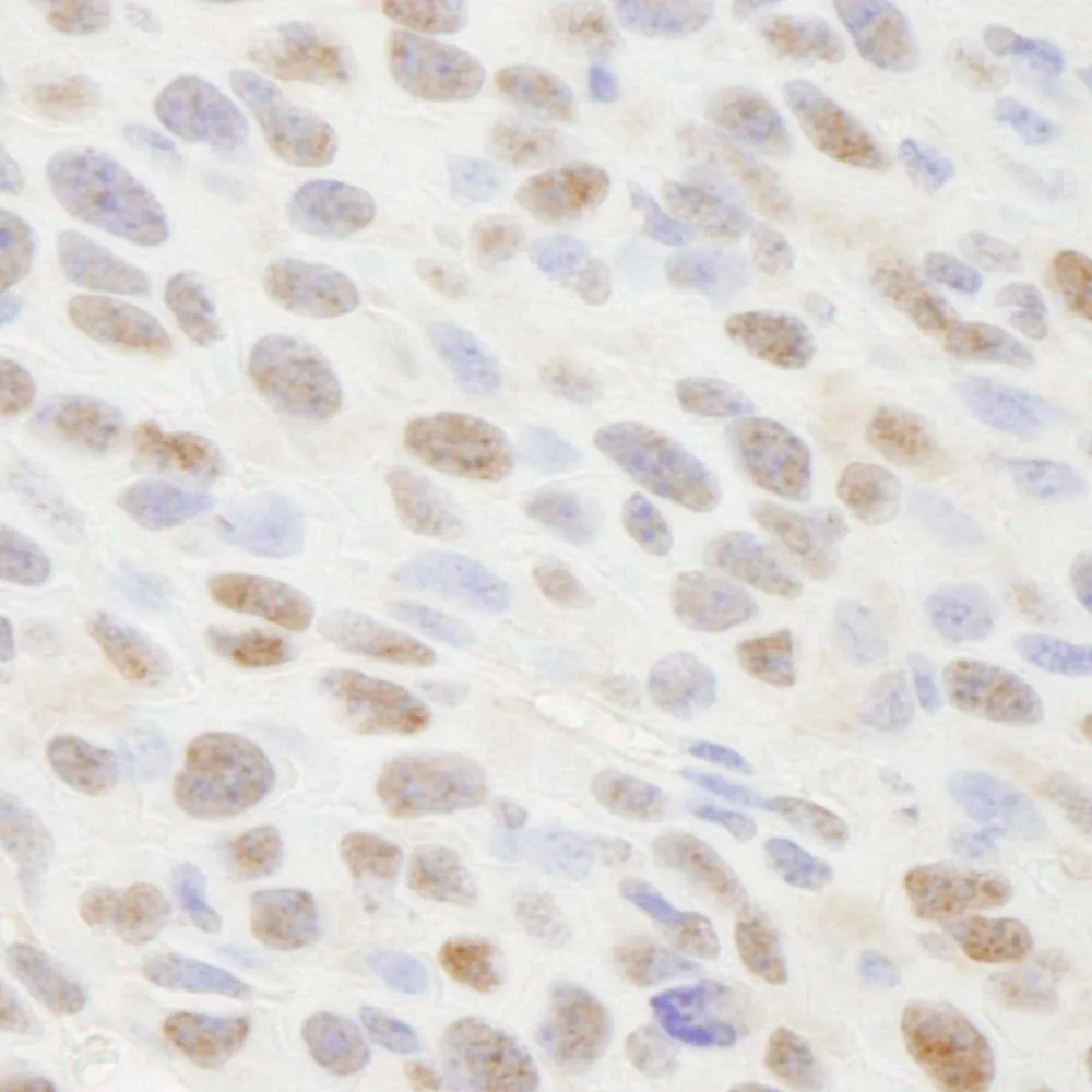 Rabbit anti-TIF1 Alpha/TRIM24 IHC Antibody, Affinity Purified
