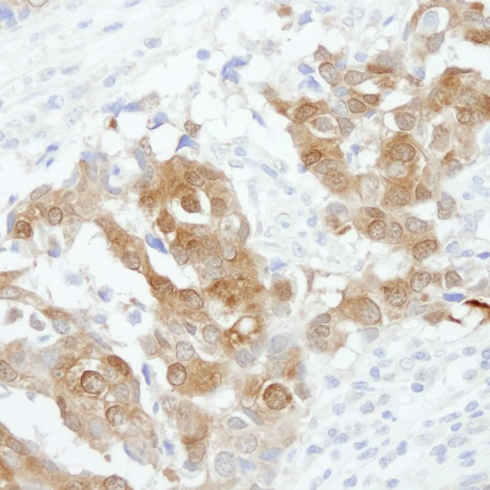Rabbit anti-CRABP2 IHC Antibody, Affinity Purified