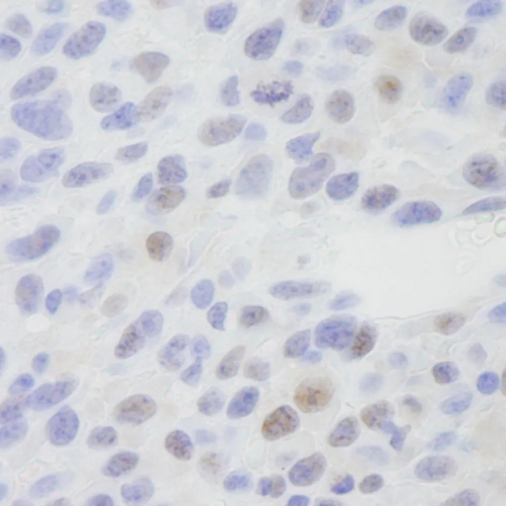 Rabbit anti-MED1 IHC Antibody, Affinity Purified