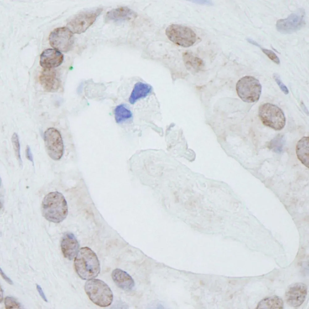 Rabbit anti-DDX24 IHC Antibody, Affinity Purified