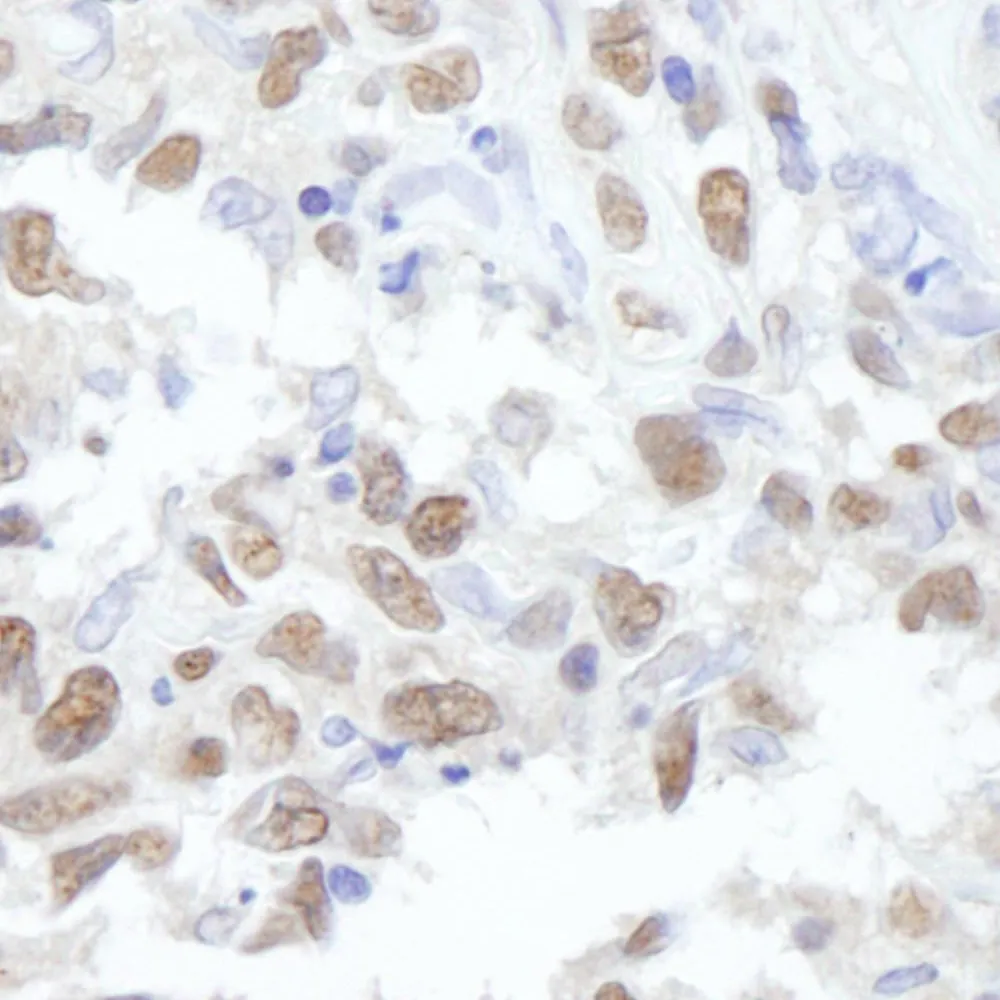Rabbit anti-PPP4C IHC Antibody, Affinity Purified
